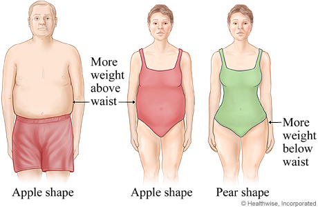 Picture of apple-shaped and pear-shaped body fat distribution